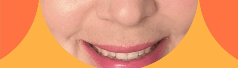 “I felt no joy or relief when treatment ended.” – Kate’s cancer story